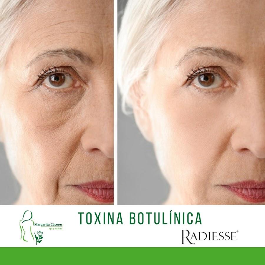 margarita caceres spa y estetica