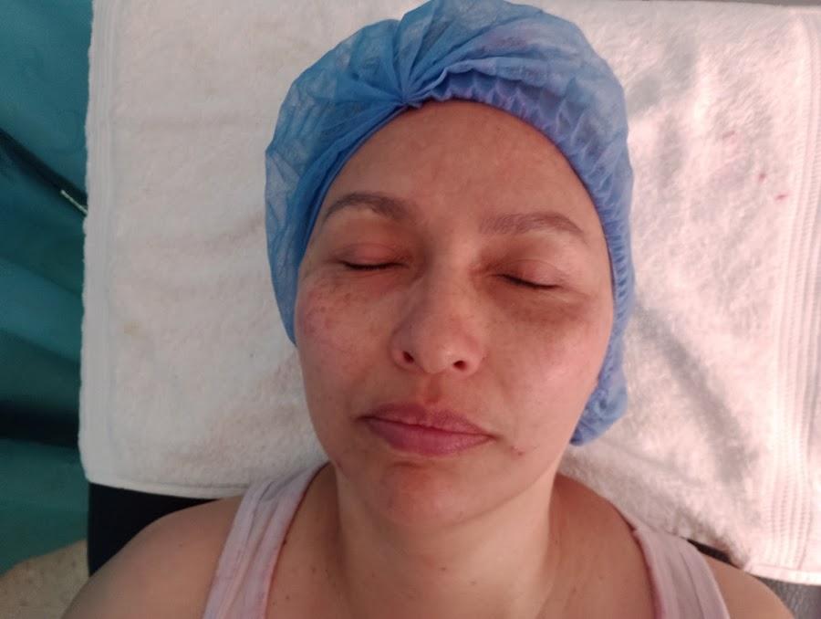 Masajes terapéuticos Ana Dorta
