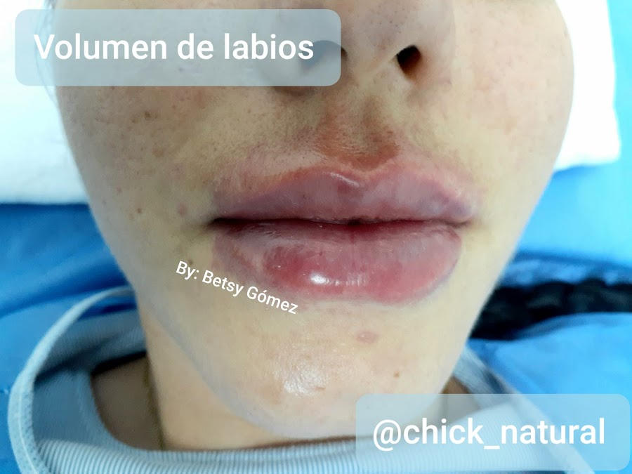 Chick Natural c.a.