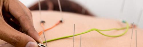 Sanio Salud Alternativa y Acupuntura